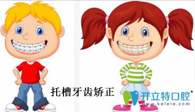 自鎖托槽和普通托槽的區(qū)別以及優(yōu)缺點(diǎn)的正確解析