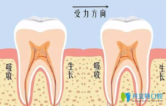 維樂口腔李書琴醫(yī)生告訴你:牙齒矯正會導(dǎo)致牙齒松動(dòng)嗎 維樂口腔李書琴醫(yī)生告訴你:牙齒矯正會導(dǎo)致牙齒松動(dòng)嗎