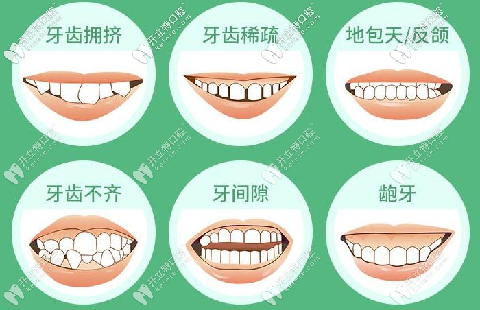 牙齒矯正的適應癥狀