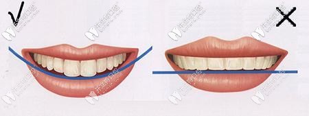 DSD美學(xué)修復(fù)